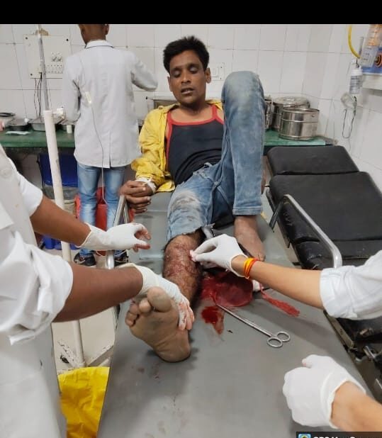 अपहरण का आरोपी आसे यादव